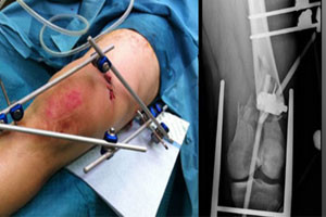 Accident-&-Polytiauma